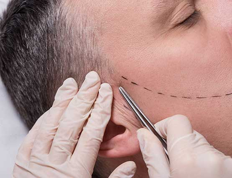 Slider image (6) Biruni Hair Institute